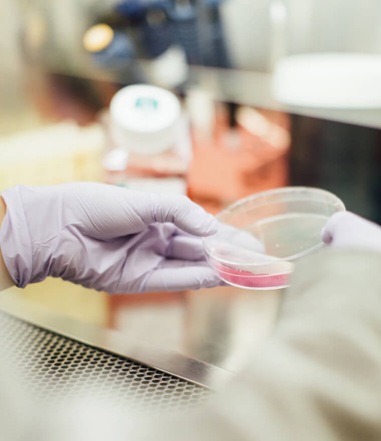 Petri dish with bacterial culture